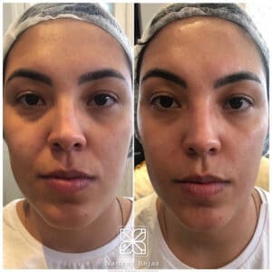 Paciente Dra Nattany Rojas Adriene Iwashita